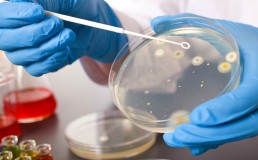 Общие вопросы в бактериологических исследованиях