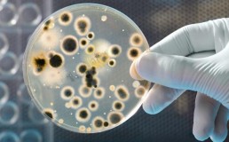 Бактериология: диагностика различных инфекций