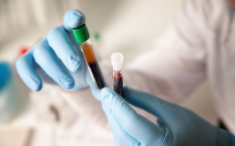 Клиническая лабораторная диагностика: органы кроветворения