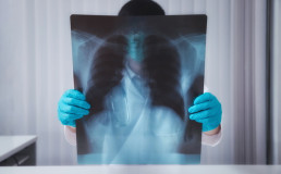 Рентгенологические исследования заболеваний органов грудной клетки