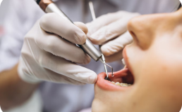 Санитарно-гигиеническое просвещение в области профилактики стоматологических заболеваний