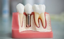 Новые технологии в стоматологии ортопедической